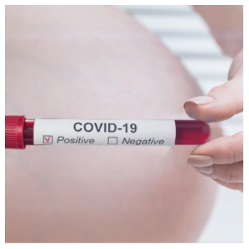 Kata Dokter: Ibu Hamil Jangan mudik Dulu yaaa...