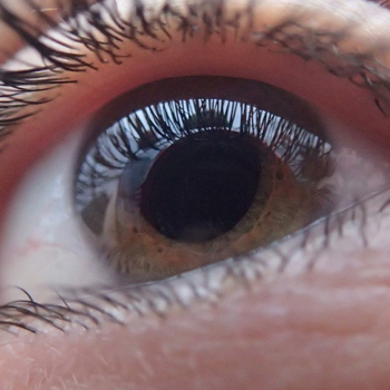 Waspada Penderita Diabetes dapat Berisiko Alami Kebutaan