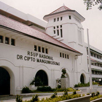 Layanan Baru RSCM untuk Anak Penderita Bibir Sumbing