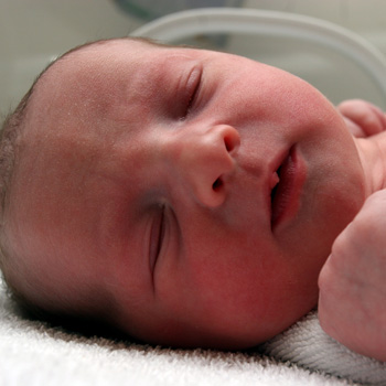 Cara Menangani dan Mencegah Pneumonia