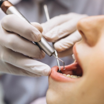 Perawatan Gigi Bunda Selama Hamil