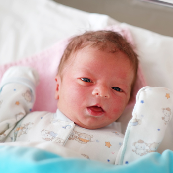 Nafsu Makan Anak Tak Terkendali? Waspadai Sindrom Prader Willi 