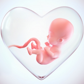 Janin Sungsang Melintang