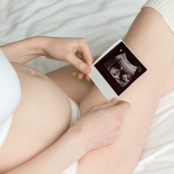 Janin Sungsang, Bisakah Lahir Normal?