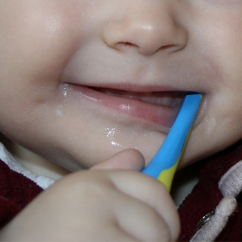 Tips Merawat Gigi Balita 