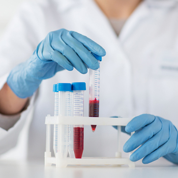 Penting, Cek Kromosom Sebelum Hamil