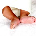 Kaki berbentuk X atau O