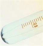 Penyakit Ensefalitis 