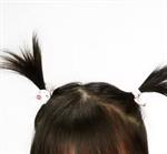 Trauma Rambut Picu Kebotakan 