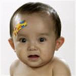 Ketika Kepala Balita Luka