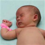 Bercak Darah Pada Bayi Baru Lahir