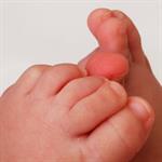 Menangani Penyakit Mulut dan Kuku