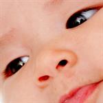 Mata Anak Juling, Perlu Operasi?