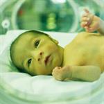 Bilirubin Bayi Baru Lahir