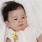 Bayi Dengan Phenyketonuria (PKU)