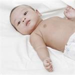 Bayi Dengan Galaktosemia Klasik