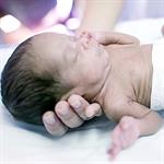 Kepala Bayi Baru Lahir