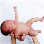 6 Gangguan Bayi yang Bisa Dideteksi