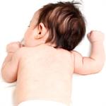 Selulitis Bukan Selulit!