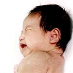 Jika Rambut Anak Telat Tumbuh 