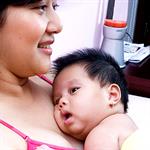 Metode Kangguru Untuk Bayi Prematur 