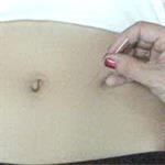 Terapi Akupunktur Untuk Kesuburan