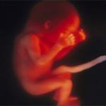 6 Gangguan Membahayakan Janin