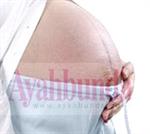 Memantau Denyut Jantung Janin 