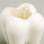 Mitos Setiap Hamil, Ada Gigi yang Tanggal