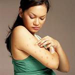 5 Gangguan Saat Hamil