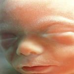 Saat Janin Kelebihan Cairan Otak 