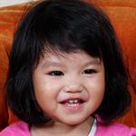 Satu Tahun Belum Tumbuh Gigi