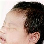 Ubun-ubun Belum Tertutup 