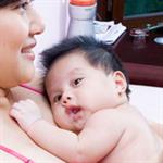 Edema Serebri Sebabkan Cacat Otak?