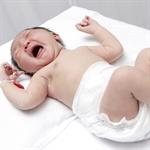 Penyebab Hernia Pada Bayi 