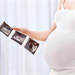 Mengenal Hydrochepalus Pada Janin