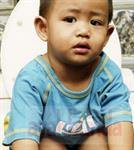 Menangani Balita Diare