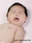 Kenali dan Atasi Gejala Pneumonia