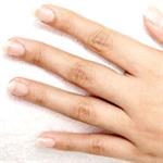 Cek Kesehatan Dari Kuku 